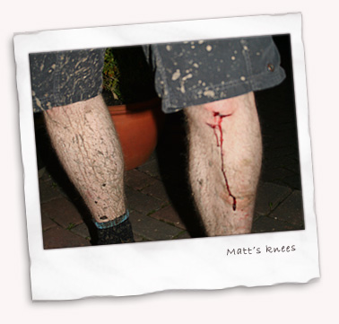 Matt's knee